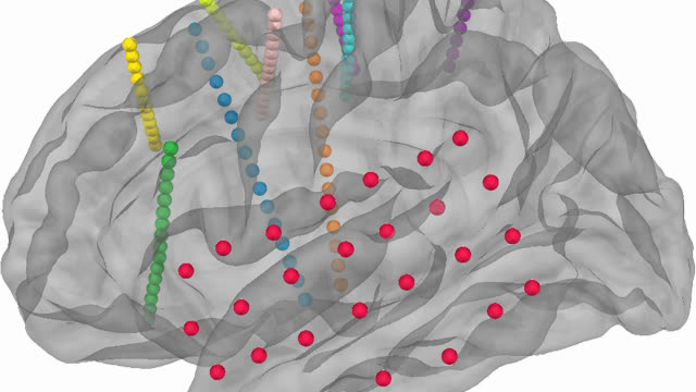 3D render of a human brain with colored depth-electrode contacts and red surface electrodes, from the package's electrode-localization plotting.